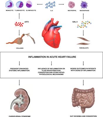 Inflammation in acute heart failure